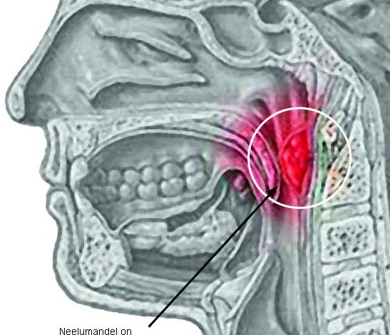 Adenoidid